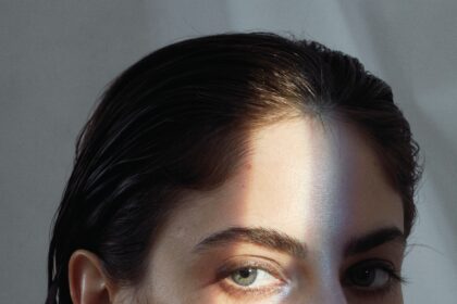 How to Treat Dark Circles, According to Dermatologists