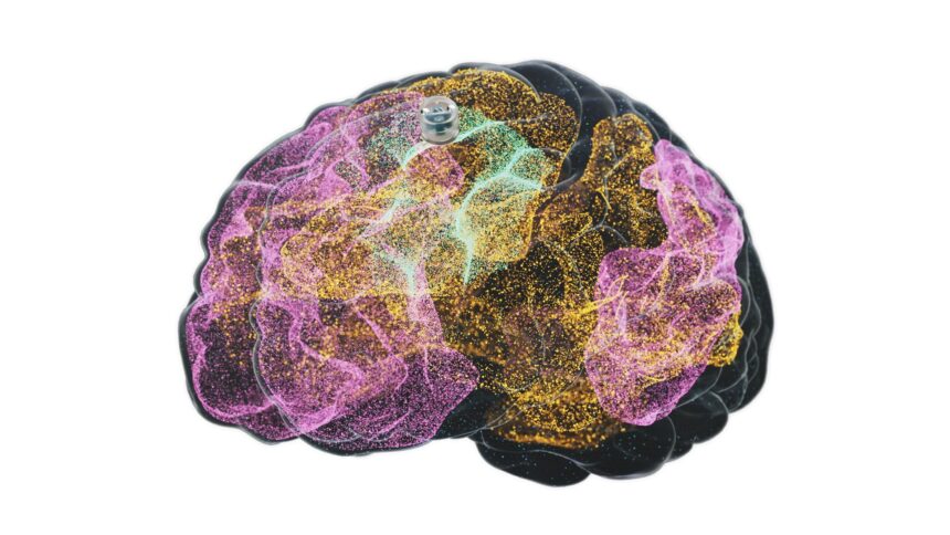 A Brain Implant for Depression Is About to Be Tested in Humans