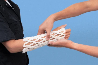 This 3D-printed cast shapes to your arm—and makes healing a broken bone more comfortable