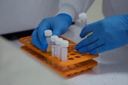 A 5 Million Bet on ‘Reversing Aging’